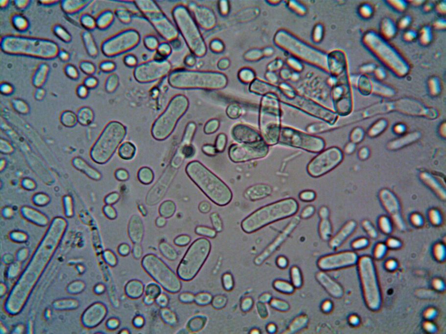 Bacteria Under a Microscope